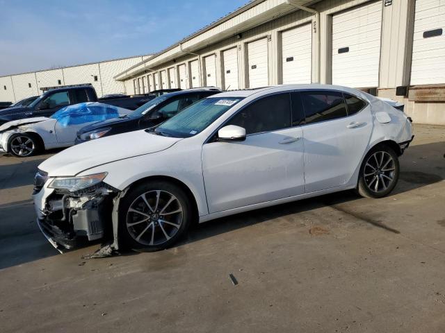 Image 1 of 2016 ACURA TLX TECH 2016 with VIN 19UUB2F58GA000991